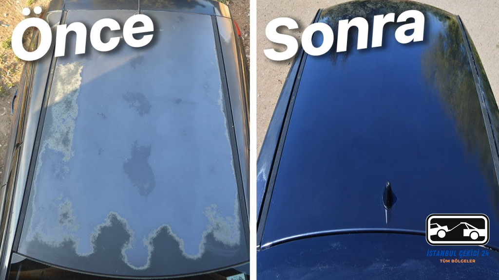 Güneş Yanığı Nasıl Geçer Araba - 1